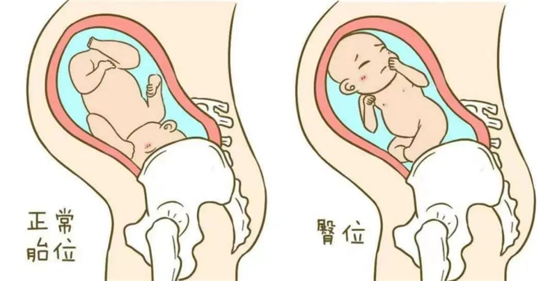 图片11.png